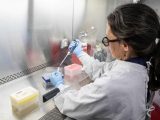 insumos de diagnóstico de hantavirus