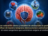 🧠🚨 “El cerebro no avisa”: Alerta para frenar infartos cerebrales a tiempo